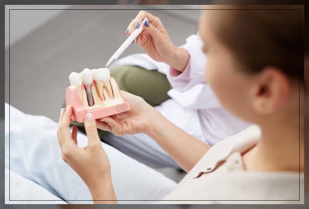 Dental implants in Dubai 2
