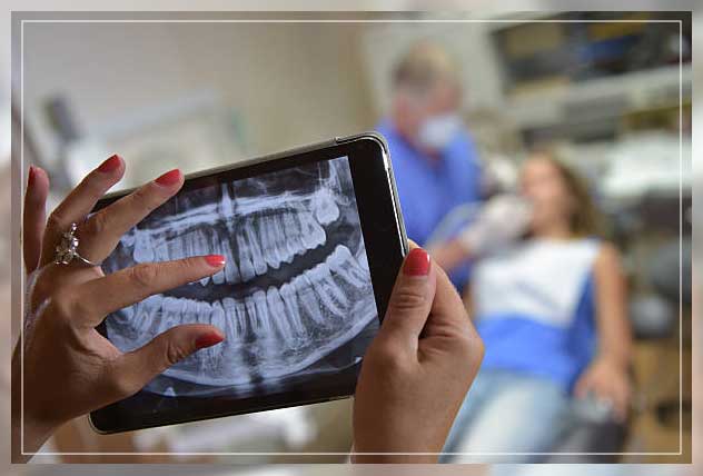 Dental x ray 3