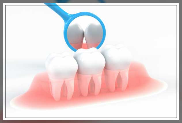 thread type and coating of mirrors