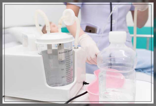 suction machine types