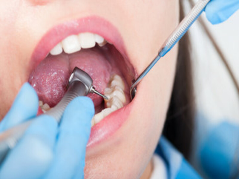 use of dental drill