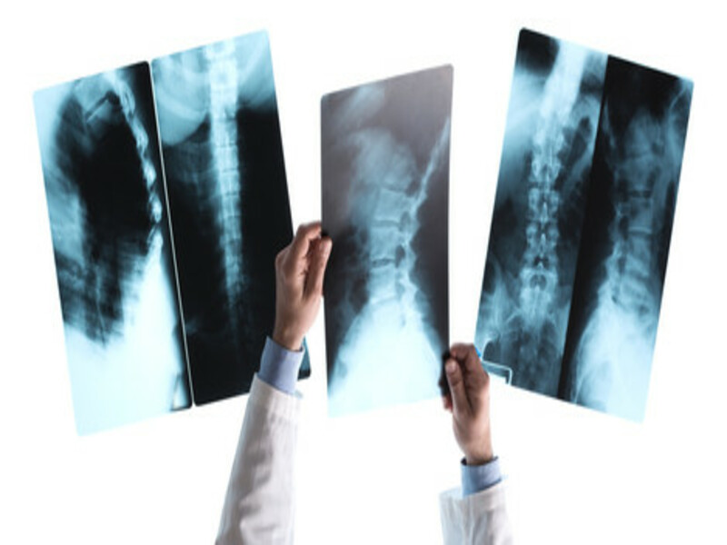 what are the uses of x-ray machine