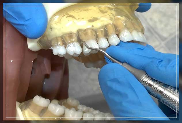 using surgical instrument on teeth