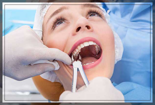 Tooth extraction tools 1