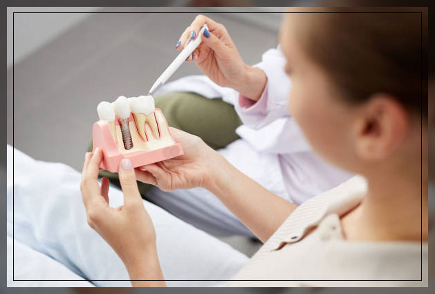 Tooth implant 4