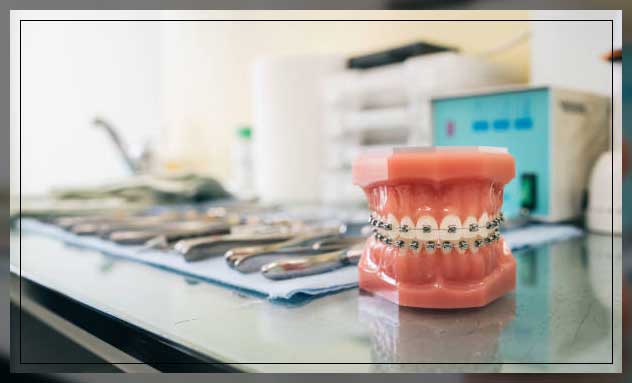 Metal braces 7