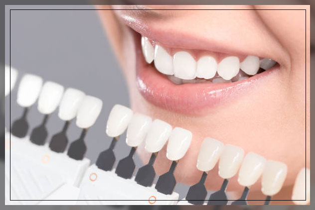 teeth whitening tactics