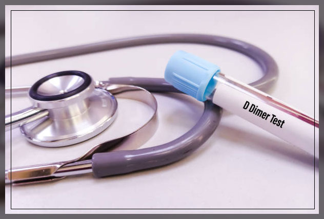d-dimer test