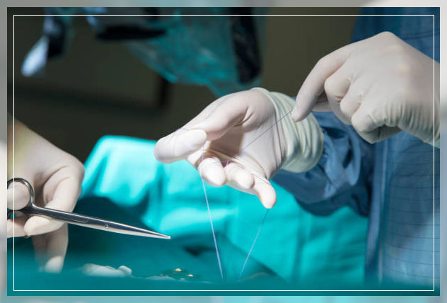 suture material