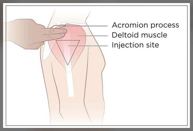 types of injections 2