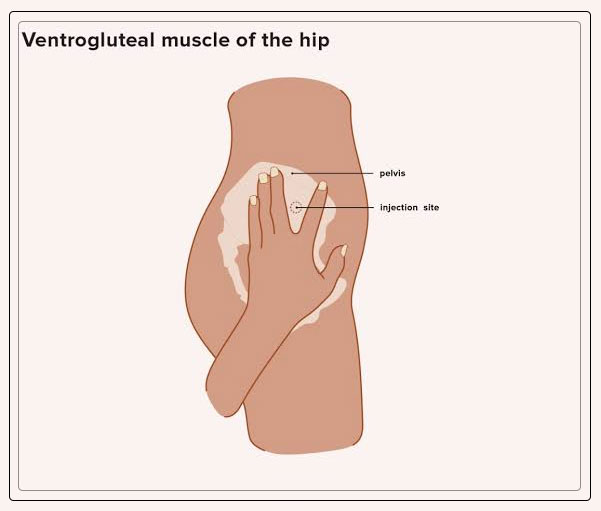 ventrogluteal muscle