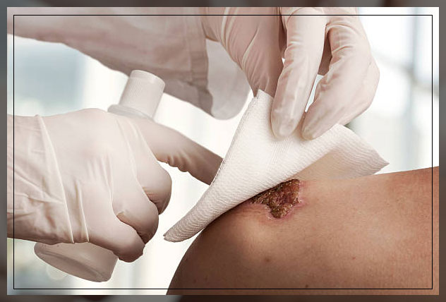 cloth and gauze wound dressings