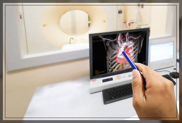 coronary angiography