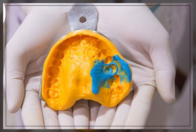 dental impression material types