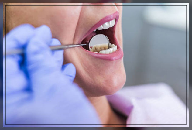 using dental mouth mirrors