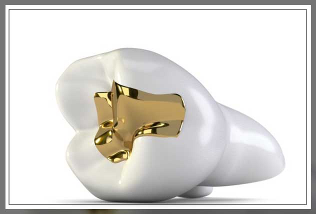 material for composite