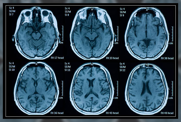 magentic resonace imaging