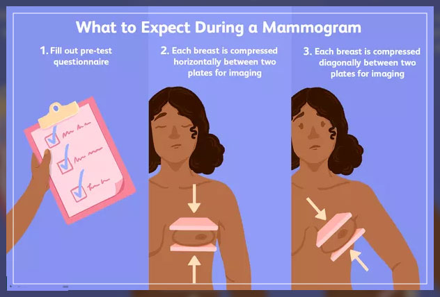 what to expect during mammography