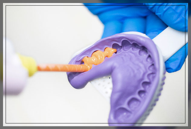 dental impression material silicone