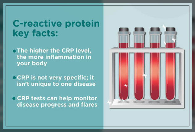 c-reative protein