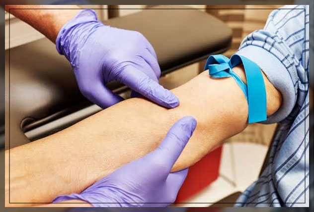 RDW blood test 2